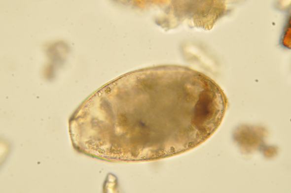 bloggparasitImg0155-Alvas-oker-149mic